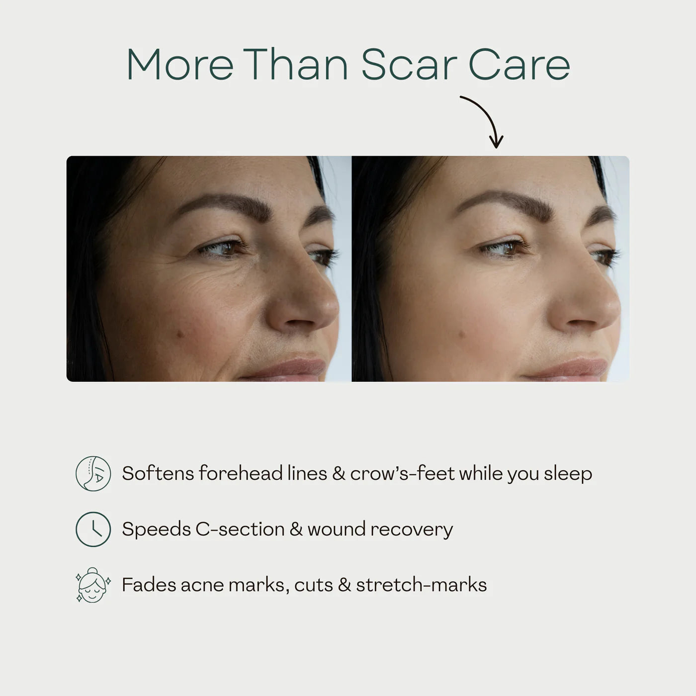 Beauty Patches