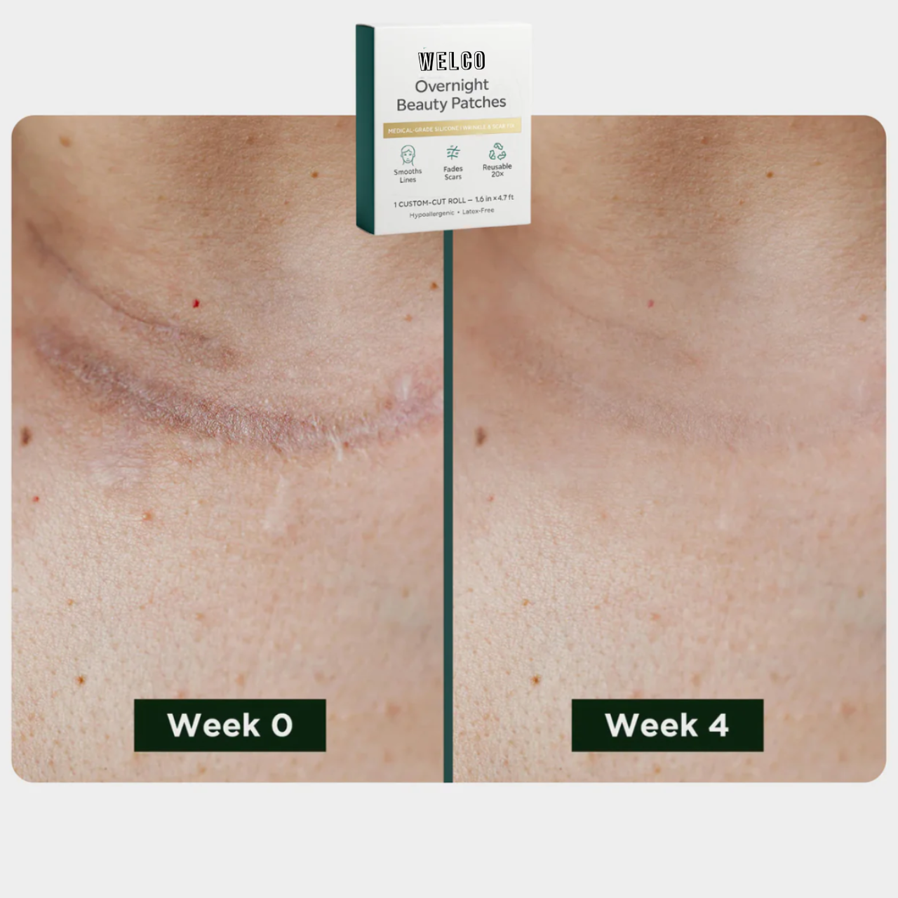 Beauty Patches